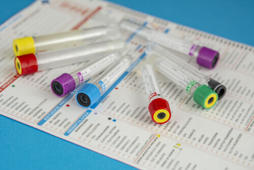 A Holistic Solution for Diagnostic Test Kit