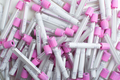 A Holistic Approach to Your Test Kit Supply Chain