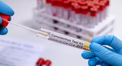 close-up of a test tube with a label that says Coronavirus Test Kit