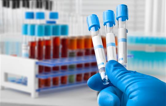 Blood sample of patient for complete screening test in laboratory